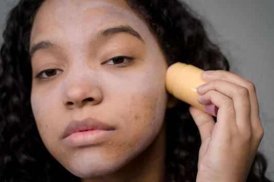Taches post-acné : comment atténuer l'hyperpigmentation
