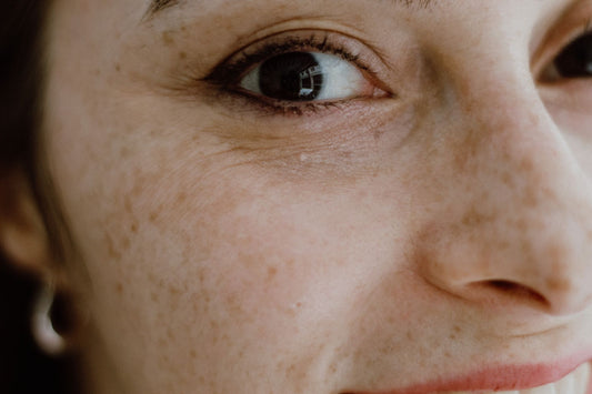 Pores dilatés visage : causes et solutions skincare